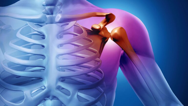 Ρήξη τένοντα ώμου: Πώς να απαλλαγείτε οριστικά από τον πόνο